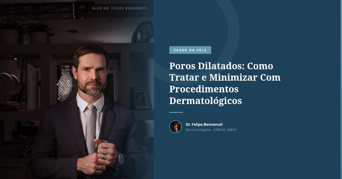 Poros Dilatados: Como Tratar e Minimizar Com Procedimentos Dermatológicos