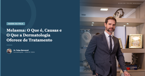 Melasma: O Que é, Causas e O Que a Dermatologia Oferece de Tratamento