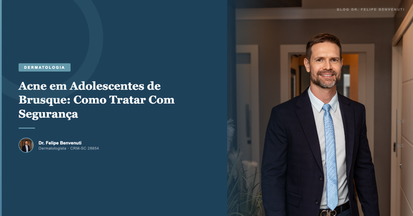 Acne em Adolescentes de Brusque: Como Tratar Com Segurança