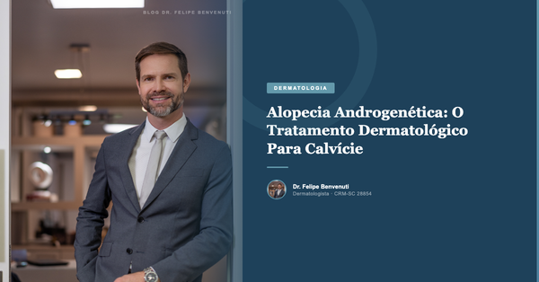 Alopecia Androgenética: O Tratamento Dermatológico Para Calvície