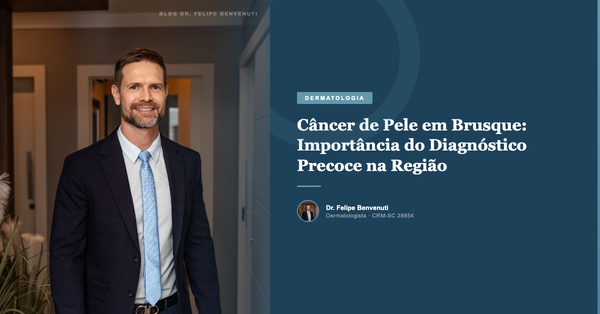 Câncer de Pele em Brusque: Importância do Diagnóstico Precoce na Região