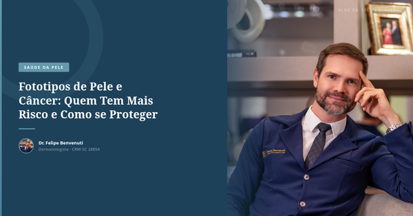 Fototipos de Pele e Câncer: Quem Tem Mais Risco e Como se Proteger