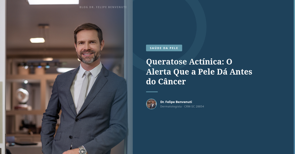 Queratose Actínica: O Alerta Que a Pele Dá Antes do Câncer