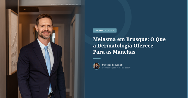 Melasma em Brusque: O Que a Dermatologia Oferece Para as Manchas