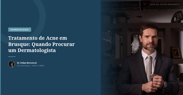 Tratamento de Acne em Brusque: Quando Procurar um Dermatologista
